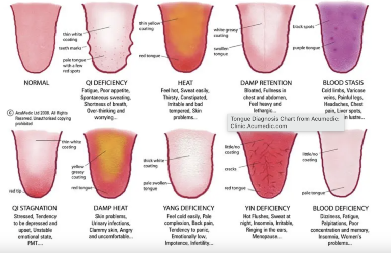 what's your tongue say?